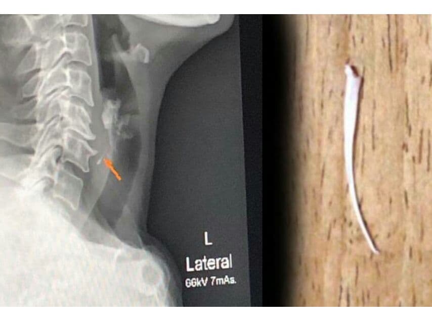 Если у вас в горле застряла кость, не надо сосать кошачью лапу! Если у вас в горле застряла кость, не надо сосать кошачью лапу!