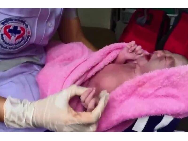 В Чонбури родилась девочка с 12-ю пальцами на руках и ногах.